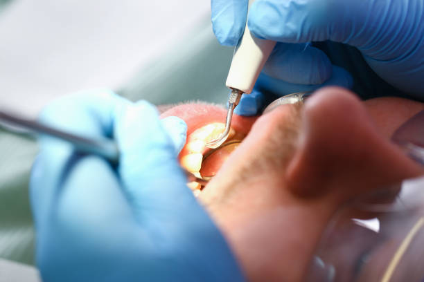 Best Emergency Dental Care for Trauma or Injury in Newington Forest, VA