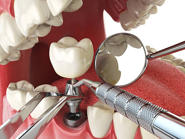 Best Pediatric Emergency Dentist in Newington Forest, VA