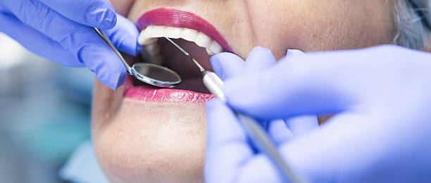 Best Emergency Broken Tooth Repair in Newington Forest, VA