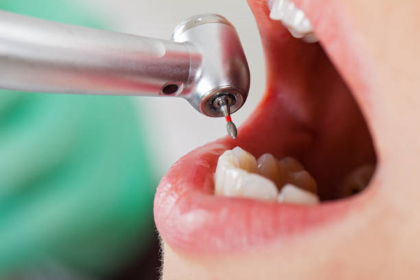 Best Weekend Emergency Dentist in Newington Forest, VA